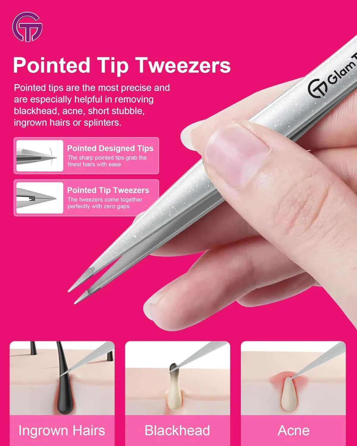 Expert Slant and Point Tip Tweezer Set with Exclusive Storage & Carrying Case, GlamTweeler Sharp & Precision Tweezer Set for Eyebrows, Facial Hairs & Fine Hairs Removal (Sparkle Baby Pink   Silver)