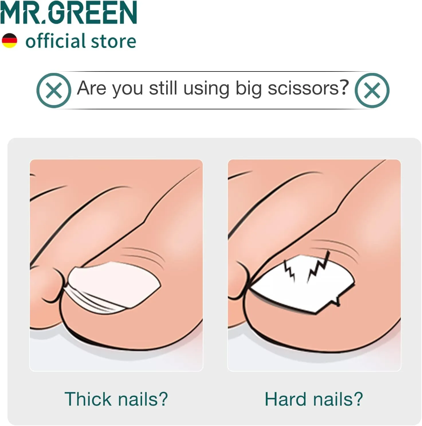 MR.GREEN Toenail Clipper Stainless Steel Ingrown Nail Cutter Good at Cutting Thick and Hard Nails Pedicure Tools (Black Nail Remover)